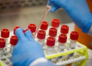 Delhi Govt. makes rapid antigen test mandatory in hospitals