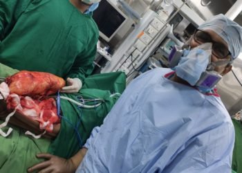 4kg tumor successfully removed from a 64-yr old man’s leg