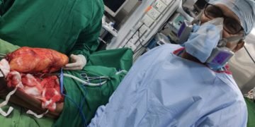 4kg tumor successfully removed from a 64-yr old man’s leg