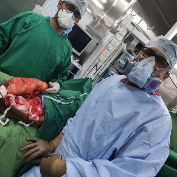 4kg tumor successfully removed from a 64-yr old man’s leg