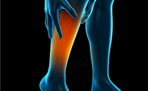 47yr old man with a rare complication of deep vein thrombosis successfully treated