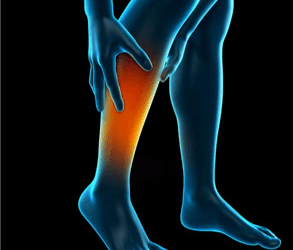 47yr old man with a rare complication of deep vein thrombosis successfully treated