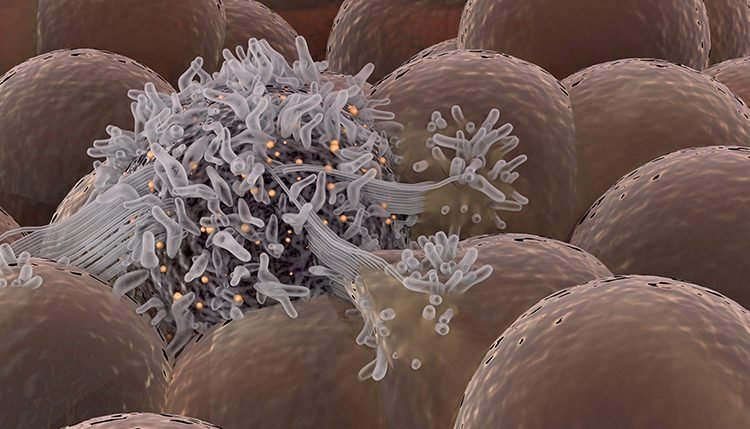 When does a cancer first arise?