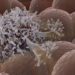 When does a cancer first arise?