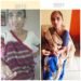 81-year-old woman with Parkinson’s successfully treated