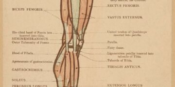 Limb saving surgery performed successfully on a 21 year-old girl