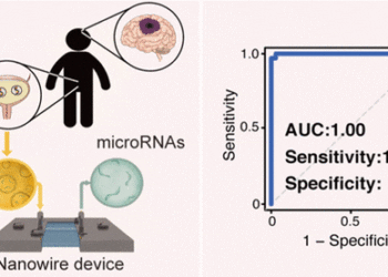 Simple urine test may help early detection of brain tumors