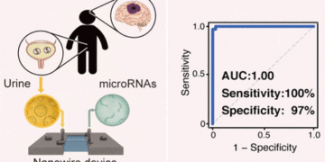 Simple urine test may help early detection of brain tumors