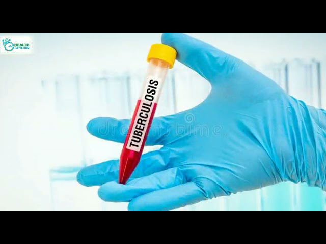 Top Health News of the Day: July 8, 2021