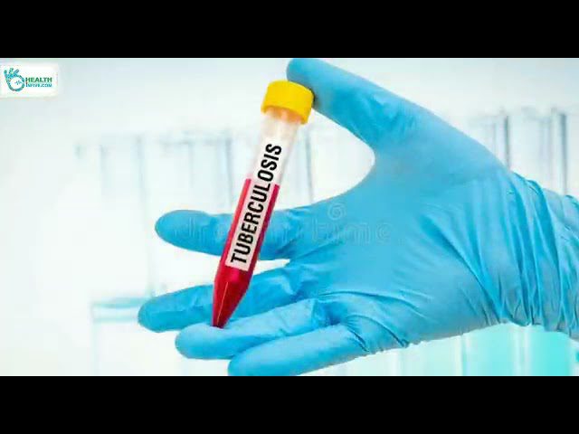 Top Health News of the Day: July 8, 2021