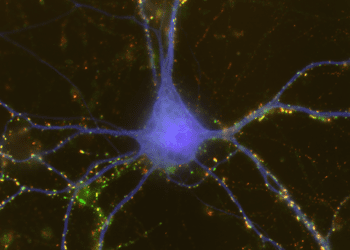 Non-neuronal cells drive sex differences in early brain development
