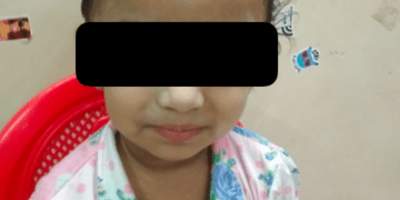 Baby with neuroblastoma successfully treated with Dinutuximab Immunotherapy at Wadia hospital