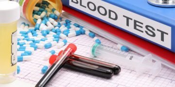 In a common genetic disorder, blood test reveals when benign tumors turn cancerous