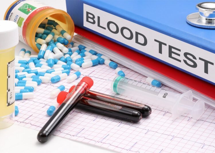 In a common genetic disorder, blood test reveals when benign tumors turn cancerous