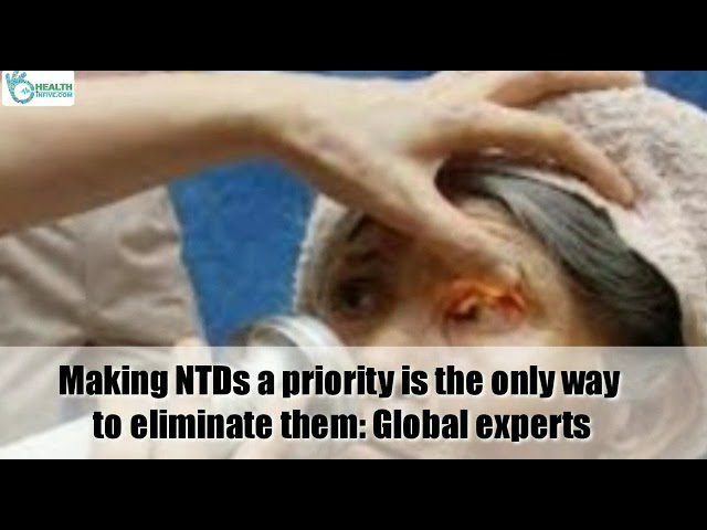 Top 10 Health News of the Day: January 31, 2022