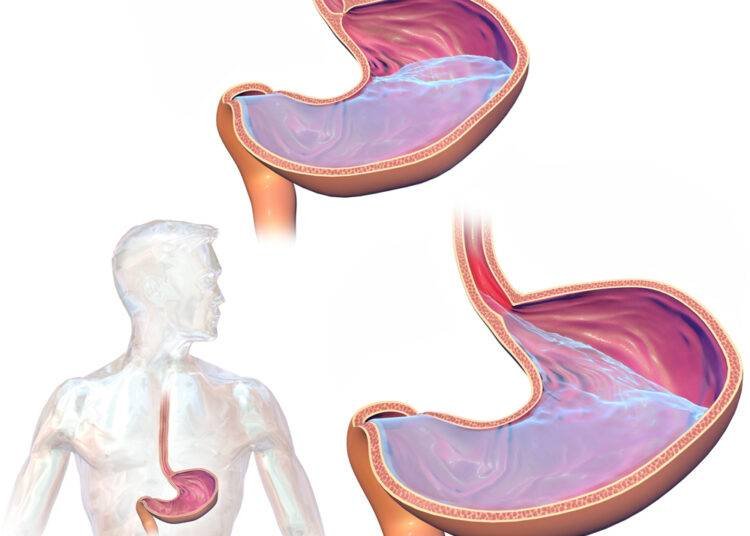 A young Kolhapur boy with GERD gets relief after 12 years