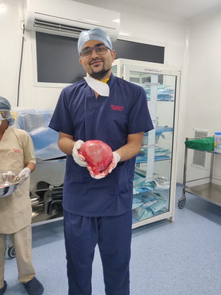 Massive uterine fibroid compression leads to extensive DVT in a  50yr-old woman