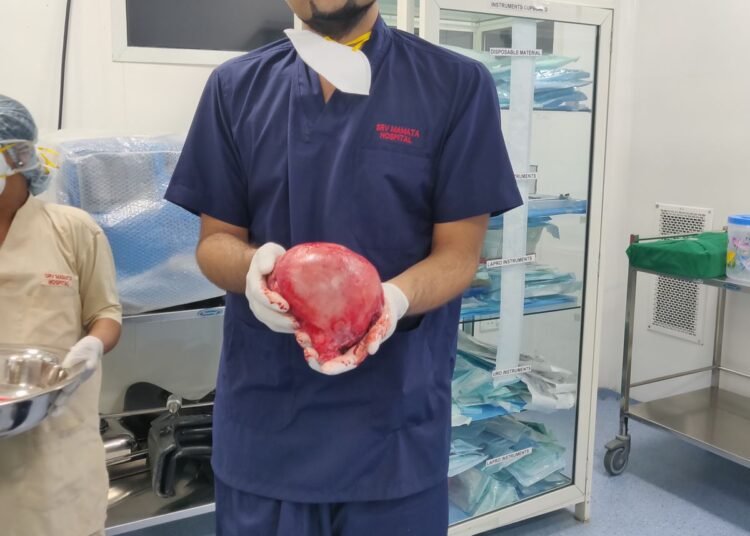 Massive uterine fibroid compression leads to extensive DVT in a  50yr-old woman