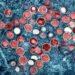 Top 10 Health News of the Day: August 1st, 2022