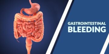 A 17yr old boy with massive upper GI bleeding due to EHPVO successfully treated