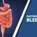 A 17yr old boy with massive upper GI bleeding due to EHPVO successfully treated