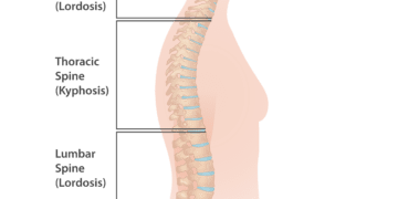 10 Daily lifestyle hacks to avoid back pain