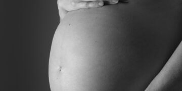 Multiple pregnancies can lead to complications in pregnant women
