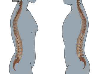 7 foods to eat for a good spinal health