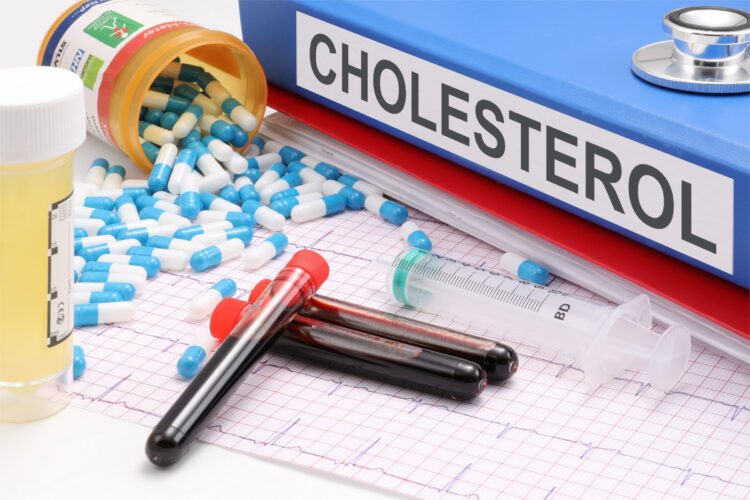 Cholesterol-lowering drugs linked to lower risk of bleeding stroke