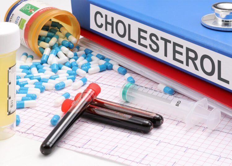 Cholesterol-lowering drugs linked to lower risk of bleeding stroke