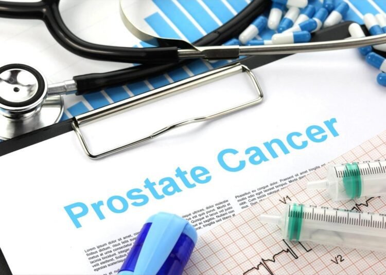 Healthy lifestyle reduces the risk of prostate cancer