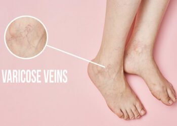 Beware gym goers: weight lifting might make your veins stick out