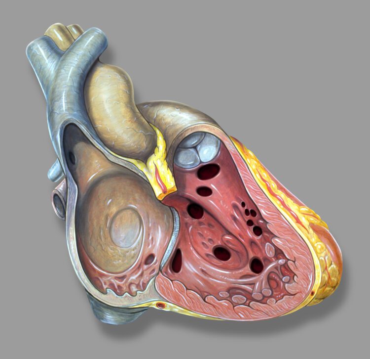 72yr-old man with life threatening rare variant of heart valve disease successfully treated