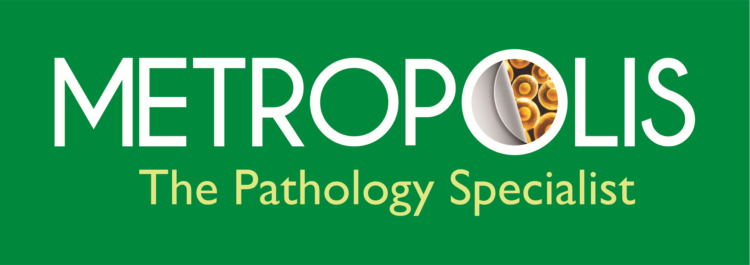 Metropolis Healthcare launches test for HSCT & solid organ transplantation