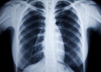 Sri Lanka Reports 9,500 TB Cases Yearly