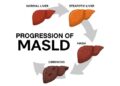 Metabolic liver disease may hit 1.8 billion globally by 2050