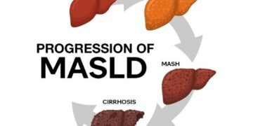 Metabolic liver disease may hit 1.8 billion globally by 2050