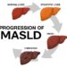 Metabolic liver disease may hit 1.8 billion globally by 2050