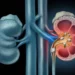 Water alone may not prevent kidney stones