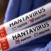 Thailand declares Hantavirus a dangerous disease