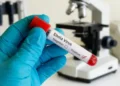 Delayed vaccine access raises global health concerns