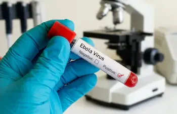 Delayed vaccine access raises global health concerns