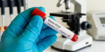 Delayed vaccine access raises global health concerns