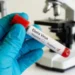 Delayed vaccine access raises global health concerns