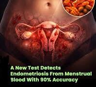 Menstrual Blood May Help Detect Endometriosis Early