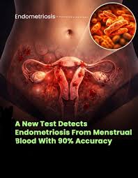 Menstrual Blood May Help Detect Endometriosis Early