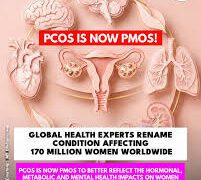 PCOS Renamed PMOS to Reflect Full Health Impact