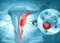 India Validates First Indigenous HPV Test for Screening