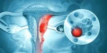 India Validates First Indigenous HPV Test for Screening
