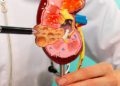 Silent Kidney Disease May Show No Early Symptoms